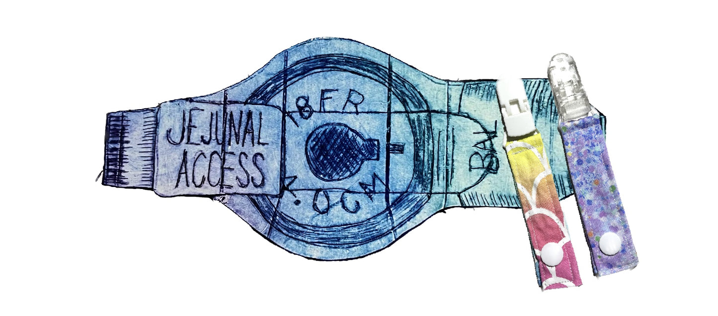 Jejunal Access