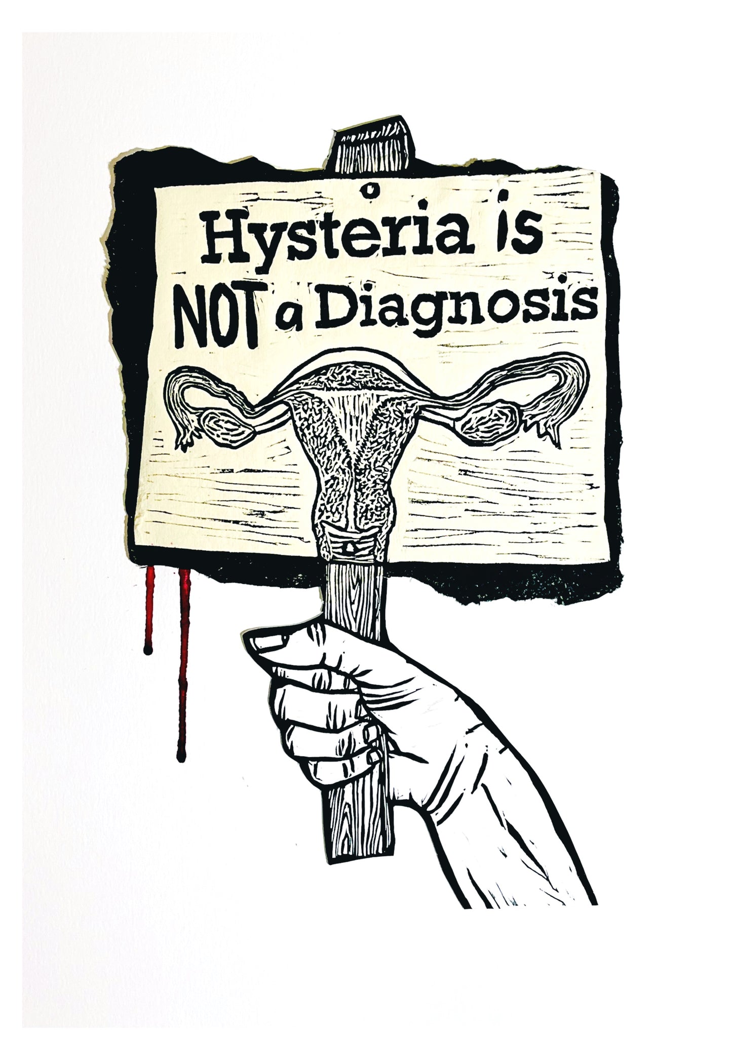 Hysteria is NOT a diagnosis!