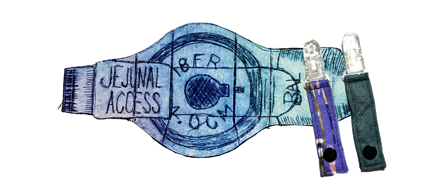 Jejunal Access