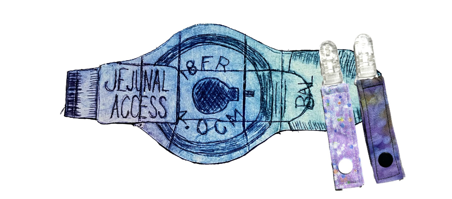 Jejunal Access