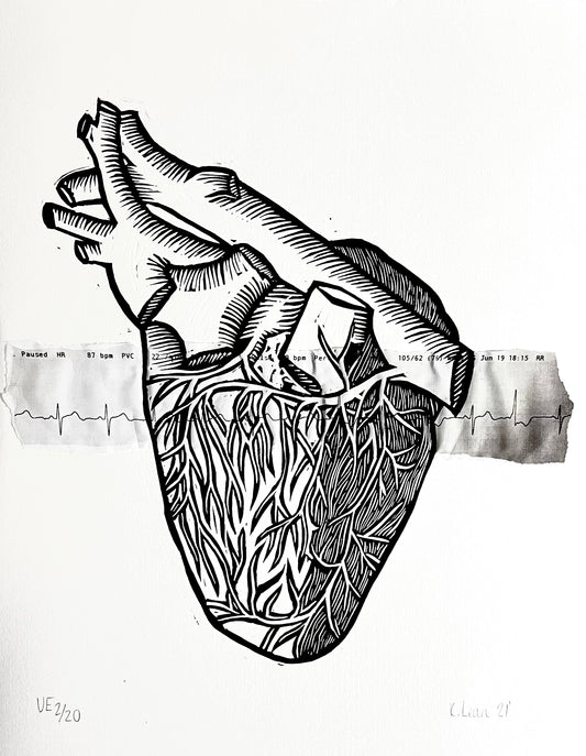 Heart (With Cardiac Tracing)